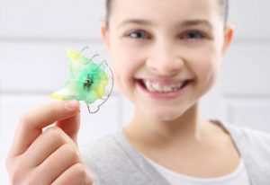 Trẻ bao nhiêu tuổi thì niềng răng