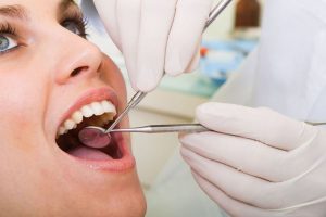Bọc răng sứ thẩm mỹ
