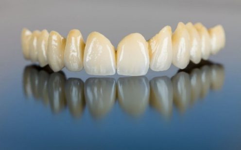 răng sứ zirconia