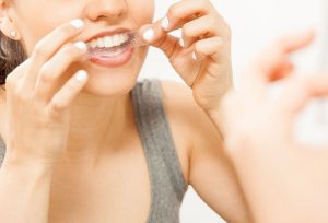 Sử dụng miếng dán trắng răng