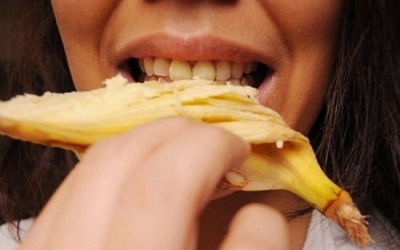 Lấy cao răng bằng vỏ chuối chỉ là giải pháp tạm thời cho những người có mảng bám cao răng không quá nhiều