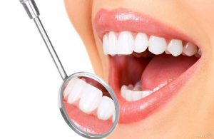 Bọc răng sứ giúp bạn sở hữu hàm răng đều đẹp chỉ ngay từ lần điều trị đầu tiên
