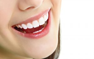 Bọc răng sứ trả góp