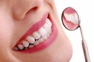 Bảng giá răng sứ veneer cập nhật mới nhất hiện nay