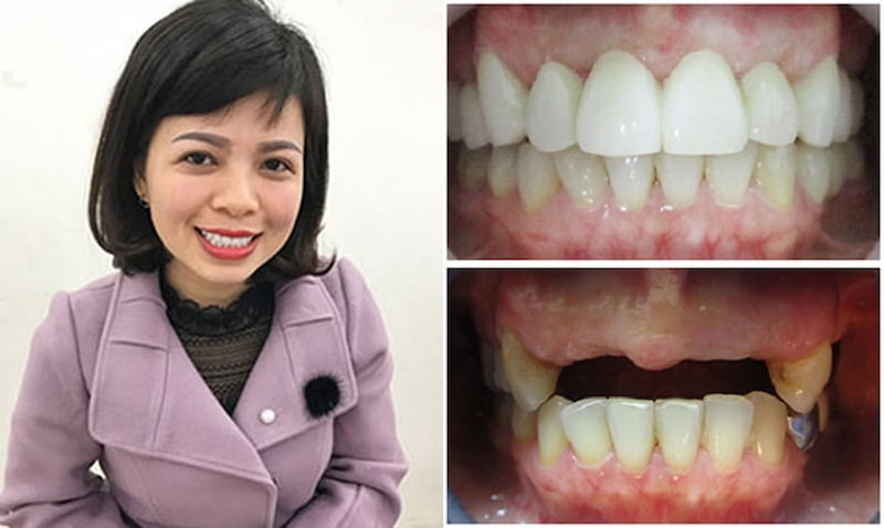 Cô Nguyễn Thu Thủy - Một khách hàng của Nha khoa ViDental