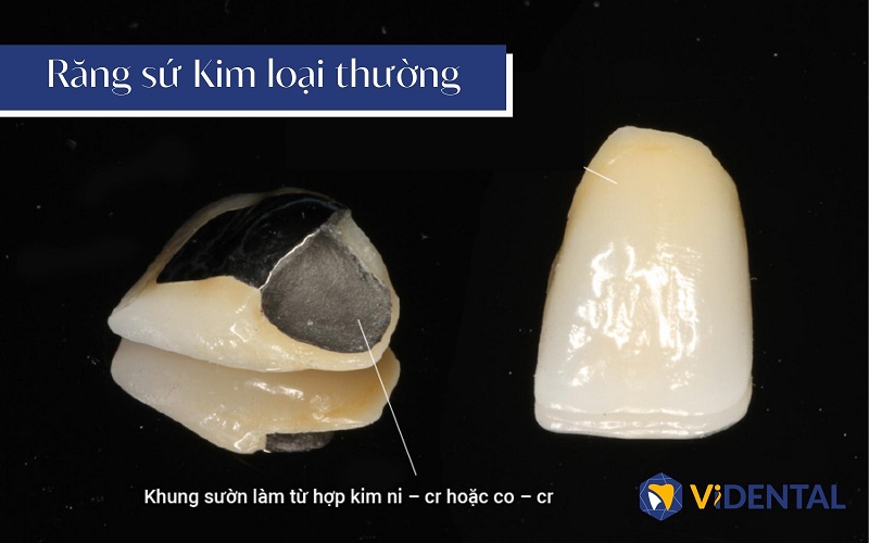 rang-su-kim-loai-1