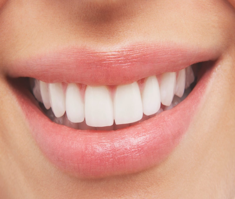 Chất liệu răng sứ sẽ quyết định trồng răng cửa giá bao nhiêu