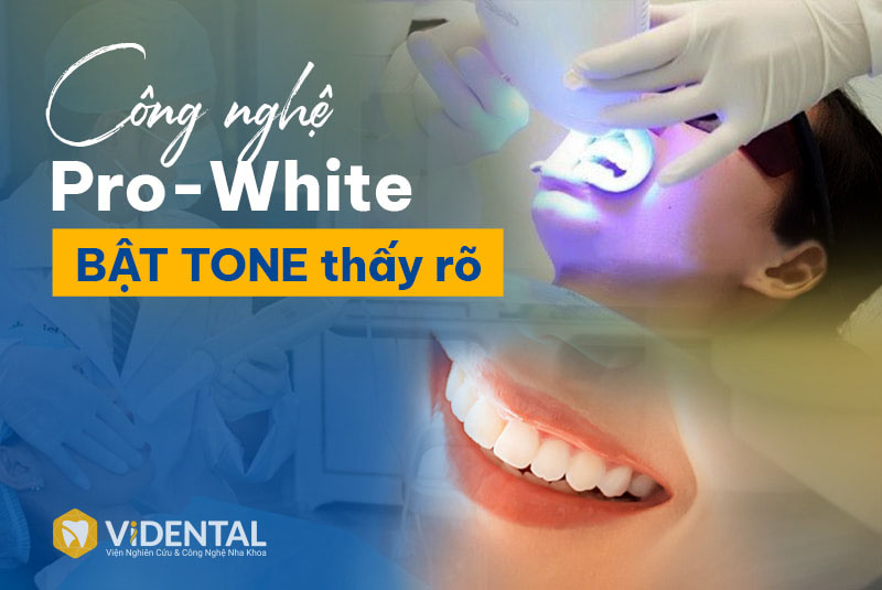 Công nghệ Laser PRO-WHITE tại Vidental mang lại nụ cười trắng sáng chỉ sau 60 phút