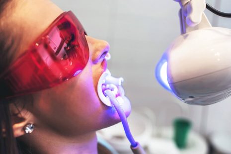Tẩy Trắng Răng Laser: Ưu, Nhược Điểm, Quy Trình Và Chi Phí Thực Hiện